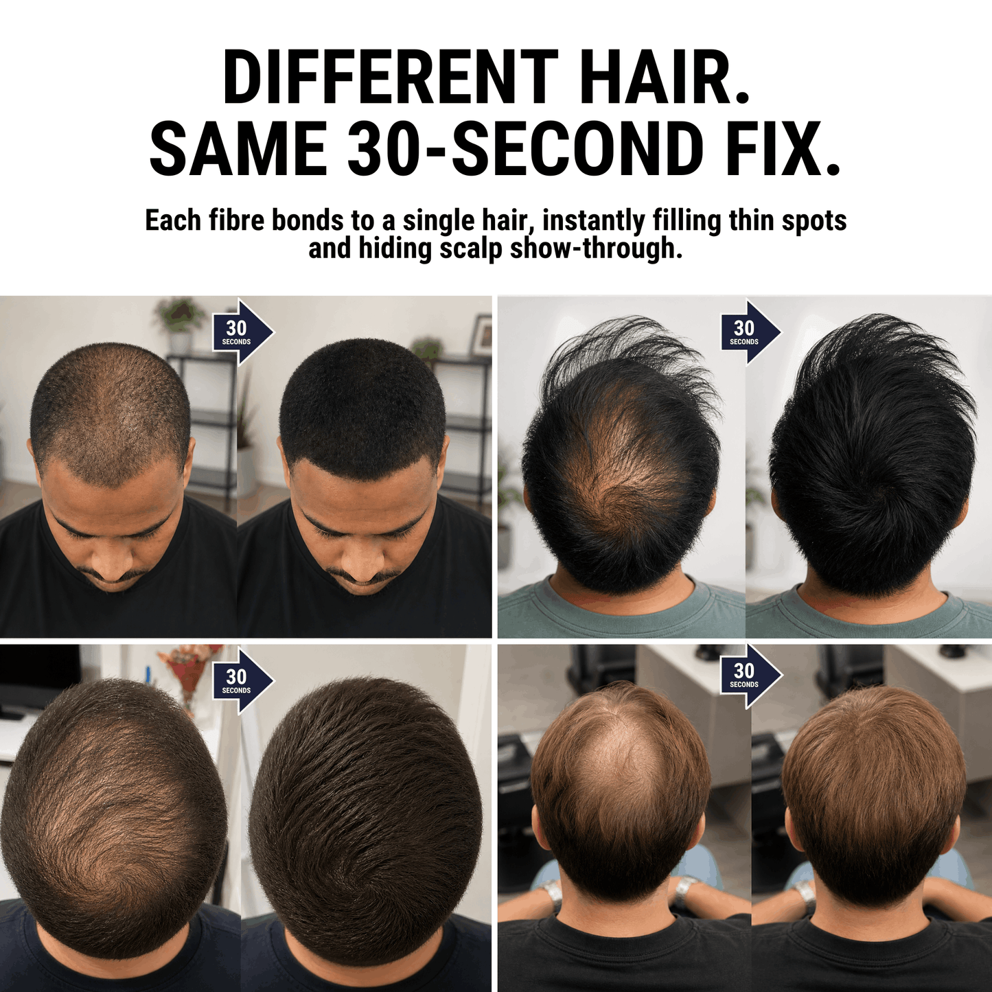 Densiq PRO - Hair Density Filler