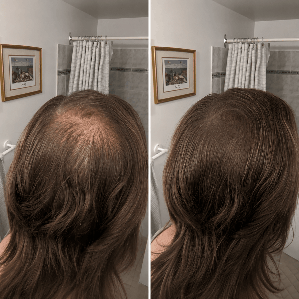 DENSIQ Pro - Instant Hair Density Filler