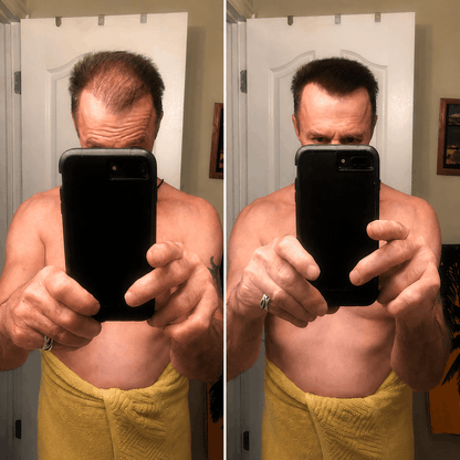 DENSIQ Pro - Instant Hair Density Filler