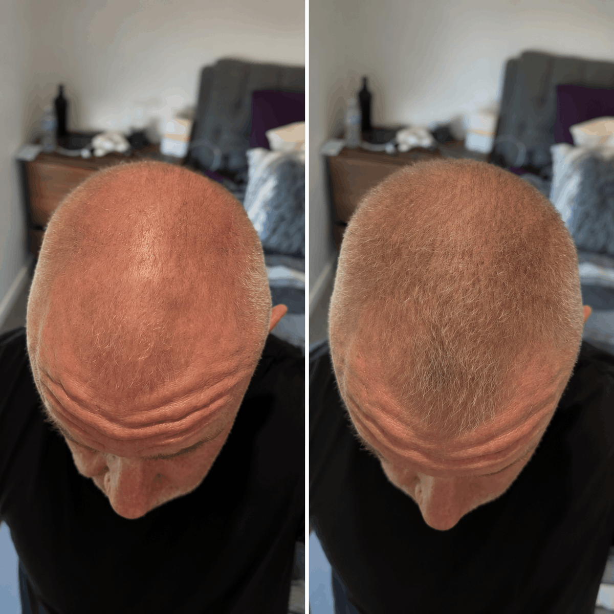 DENSIQ Pro - Instant Hair Density Filler