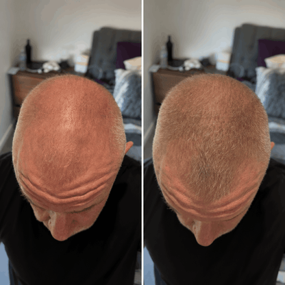 DENSIQ Pro - Instant Hair Density Filler